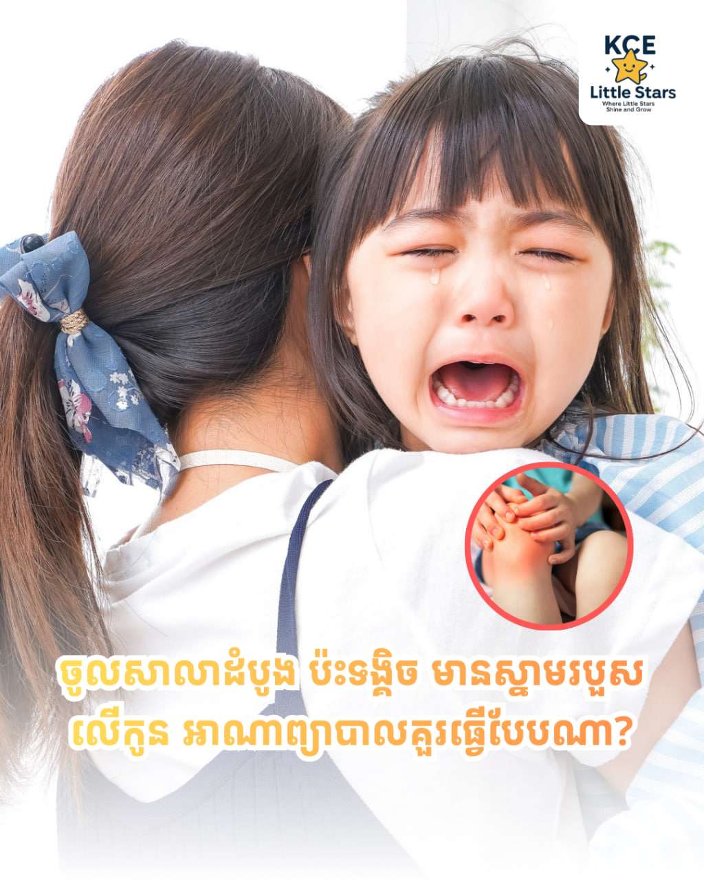 Young child crying while being comforted by an adult, representing emotional development and learning moments in early childhood education